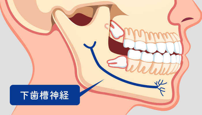 口腔外科で抜いたほうがいい歯はどんな歯？